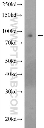 PARP9 Antibody in Western Blot (WB)