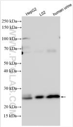 GGTLC1 Antibody in Western Blot (WB)