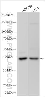 ARPC1A Antibody in Western Blot (WB)