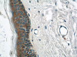 TRIM29 Antibody in Immunohistochemistry (Paraffin) (IHC (P))