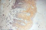 TRIM29 Antibody in Immunohistochemistry (Paraffin) (IHC (P))