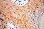 TRIM29 Antibody in Immunohistochemistry (Paraffin) (IHC (P))