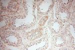 TRIM29 Antibody in Immunohistochemistry (Paraffin) (IHC (P))