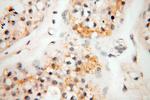 TRIM29 Antibody in Immunohistochemistry (Paraffin) (IHC (P))