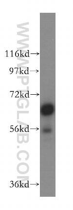 TRIM29 Antibody in Western Blot (WB)