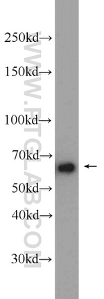 TRIM29 Antibody in Western Blot (WB)