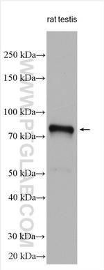 DDX4, VASA Antibody in Western Blot (WB)