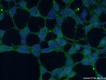 PIP5KL1 Antibody in Immunocytochemistry (ICC/IF)
