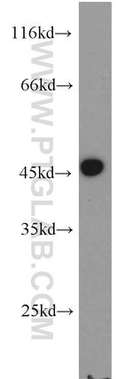 PIP5KL1 Antibody in Western Blot (WB)
