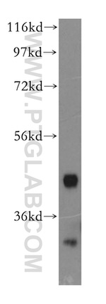 PIP5KL1 Antibody in Western Blot (WB)