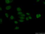 HDAC8 Antibody in Immunocytochemistry (ICC/IF)