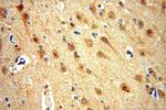 PTPN18 Antibody in Immunohistochemistry (Paraffin) (IHC (P))