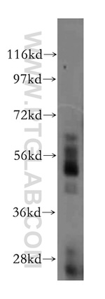 PTPN18 Antibody in Western Blot (WB)