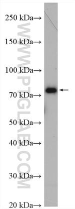 MTMR12 Antibody in Western Blot (WB)