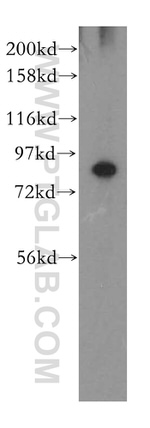 MTMR12 Antibody in Western Blot (WB)