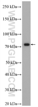 MTMR12 Antibody in Western Blot (WB)