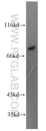 MTMR12 Antibody in Western Blot (WB)