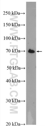 MTMR12 Antibody in Western Blot (WB)