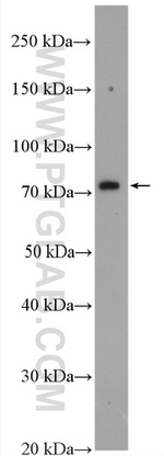 MTMR12 Antibody in Western Blot (WB)
