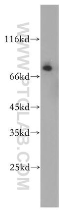 MTA2 Antibody in Western Blot (WB)