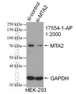MTA2 Antibody in Western Blot (WB)