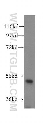 TRMT11 Antibody in Western Blot (WB)
