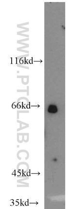 Calpain 9 Antibody in Western Blot (WB)