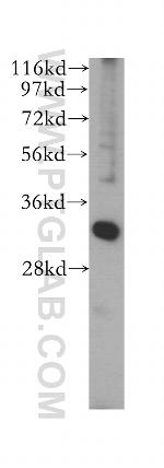 SLC25A34 Antibody in Western Blot (WB)