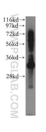 SLC25A34 Antibody in Western Blot (WB)