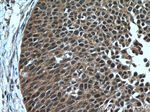 RMND5A Antibody in Immunohistochemistry (Paraffin) (IHC (P))