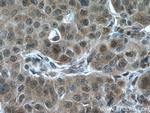 RMND5A Antibody in Immunohistochemistry (Paraffin) (IHC (P))
