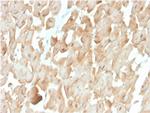 Dystrophin (DMD) (Marker of Duchenne and Becker Muscular Dystrophy) Antibody in Immunohistochemistry (Paraffin) (IHC (P))