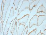 Dystrophin (DMD) (Marker of Duchenne and Becker Muscular Dystrophy) Recombinant Rabbit Monoclonal Antibody (DMD/8773R)