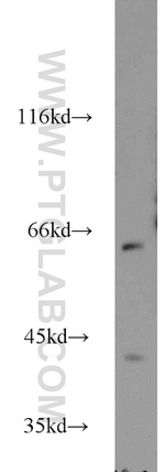 KATNA1 Antibody in Western Blot (WB)