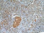RIP3 Antibody in Immunohistochemistry (Paraffin) (IHC (P))