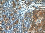 RIP3 Antibody in Immunohistochemistry (Paraffin) (IHC (P))