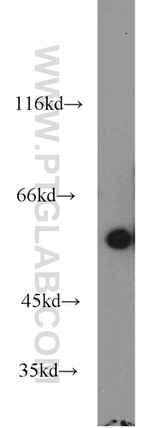 RIP3 Antibody in Western Blot (WB)
