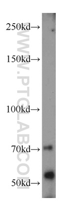 RIP3 Antibody in Western Blot (WB)