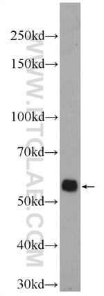 RIP3 Antibody in Western Blot (WB)