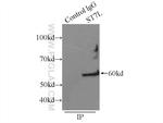 ST7L Antibody in Immunoprecipitation (IP)