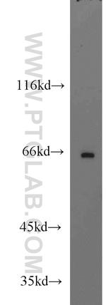 ST7L Antibody in Western Blot (WB)