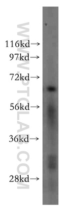 ST7L Antibody in Western Blot (WB)