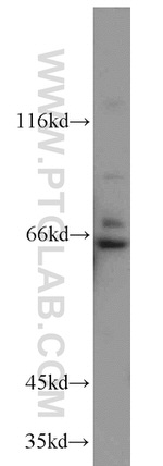 PLEKHA9 Antibody in Western Blot (WB)