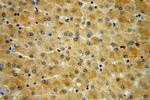 ACOX2 Antibody in Immunohistochemistry (Paraffin) (IHC (P))