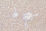 ACOX2 Antibody in Immunohistochemistry (Paraffin) (IHC (P))