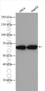 THNSL2 Antibody in Western Blot (WB)