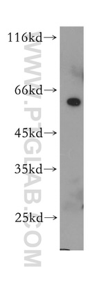 THNSL2 Antibody in Western Blot (WB)