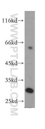 THNSL2 Antibody in Western Blot (WB)