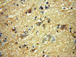 MCTP2 Antibody in Immunohistochemistry (Paraffin) (IHC (P))