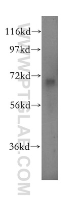 ADCK5 Antibody in Western Blot (WB)